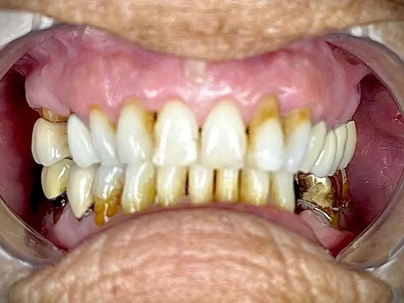 Circle Dental Group before and after 
