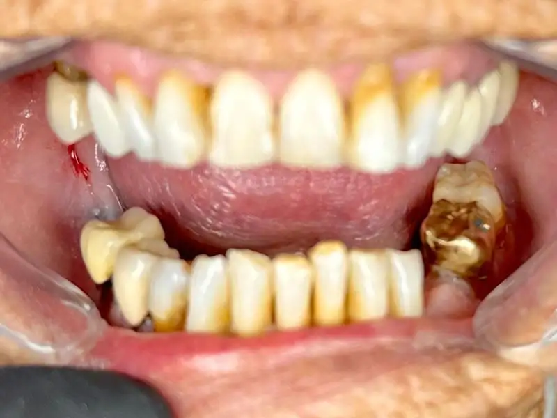 Circle Dental Group before and after 