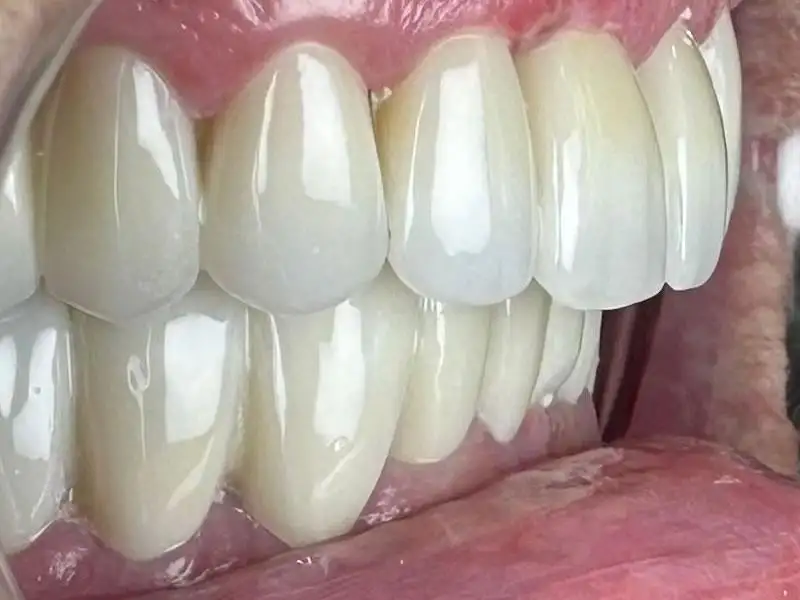 Circle Dental Group before and after 