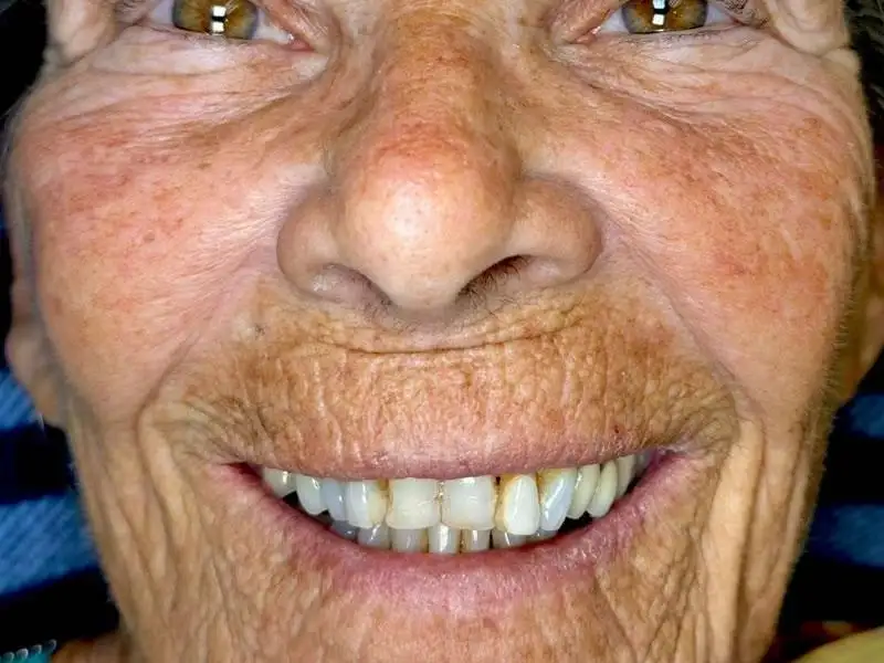 Circle Dental Group before and after 