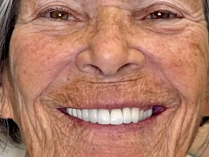 Circle Dental Group before and after 