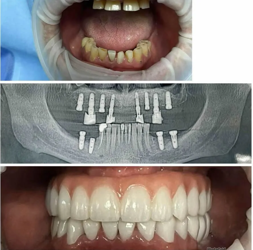 Innova Dental Implant Center