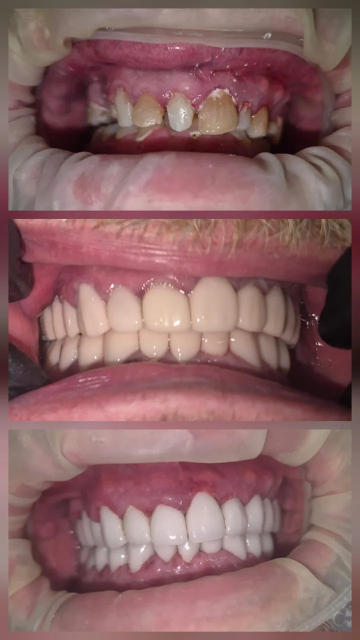 Innova Dental Implant Center