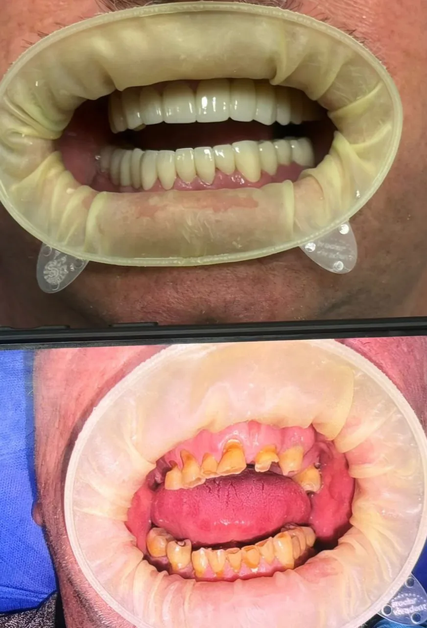 Innova Dental Implant Center