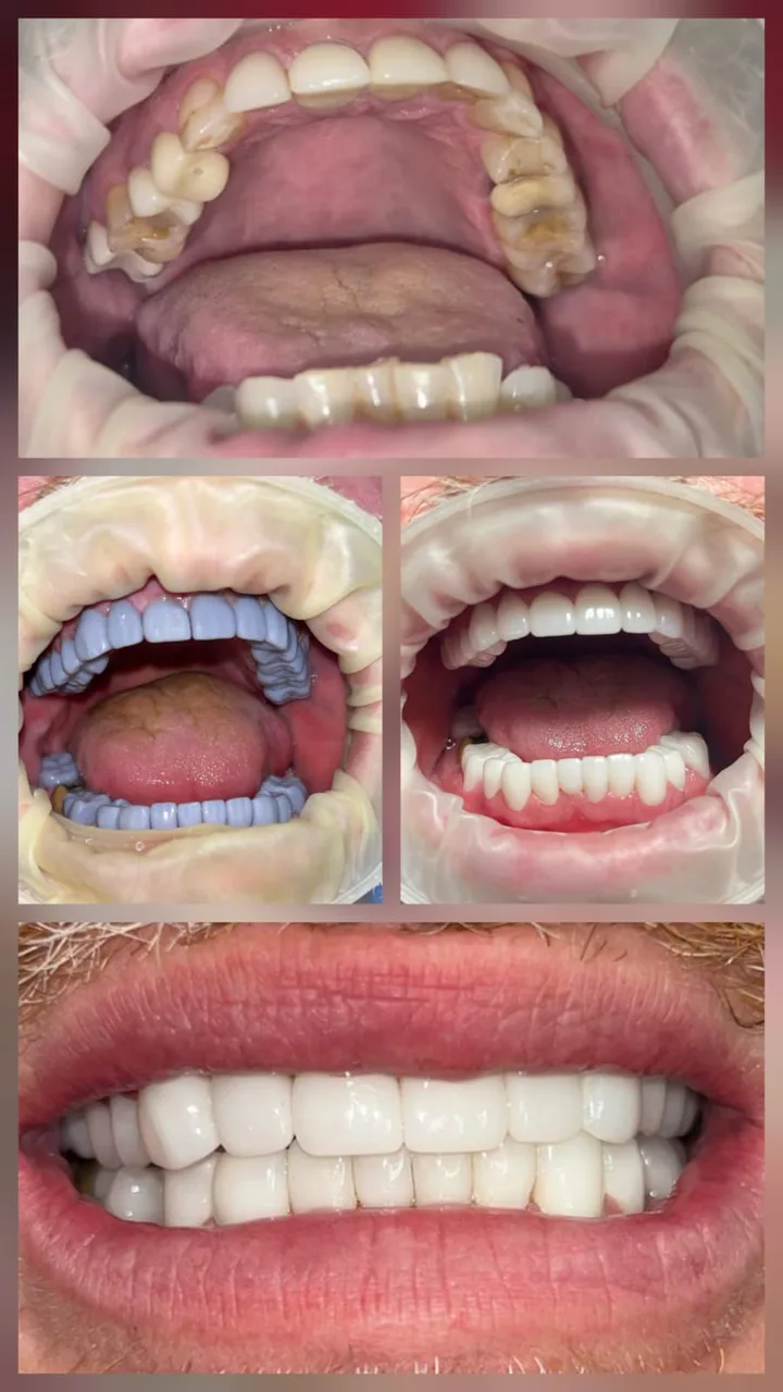 Innova Dental Implant Center