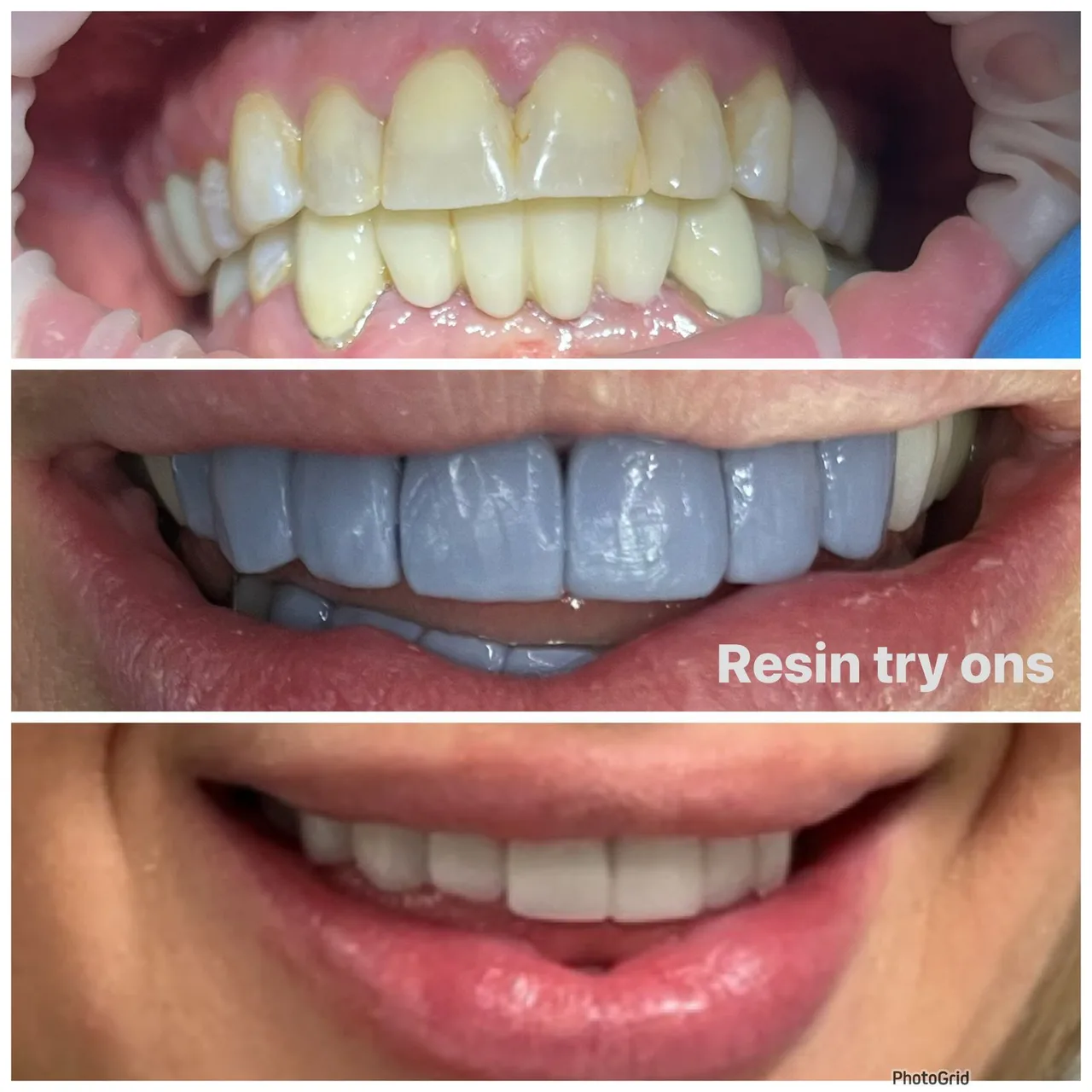 Innova Dental Implant Center