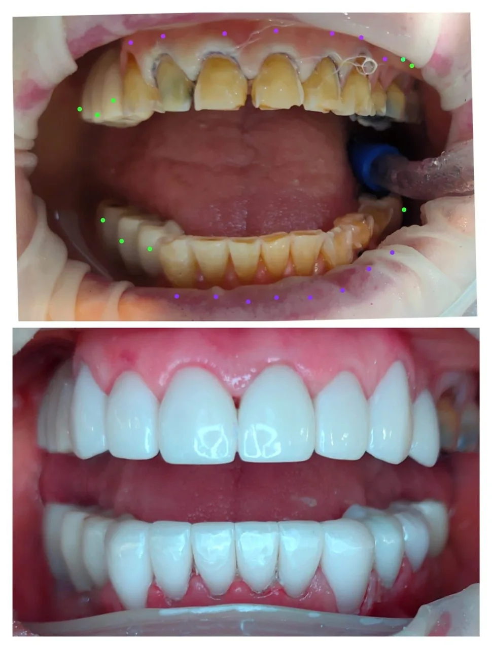 Innova Dental Implant Center
