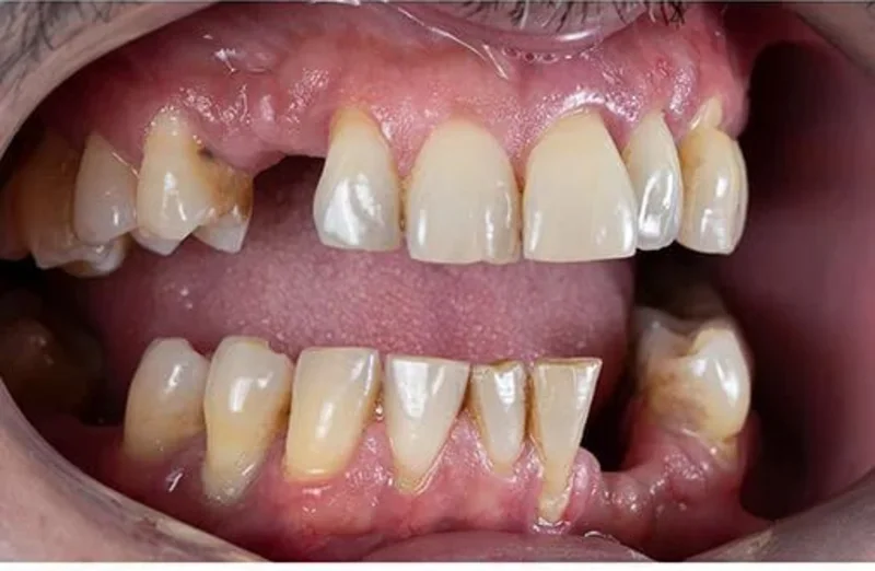Before — damaged teeth