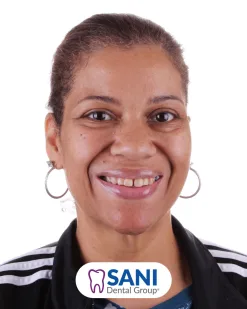 After: Zirconia Crown & Implant at Sani Dental Group