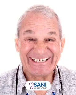 After: Zirconia Crown at Sani Dental Group
