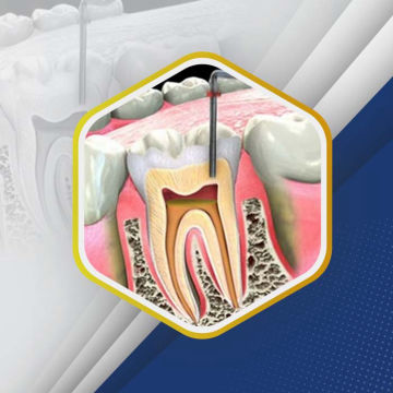 Dental Crown