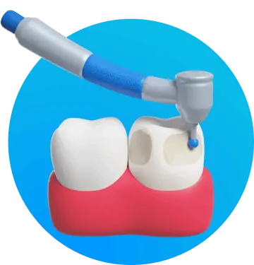 Root canal price list in Los Algodones