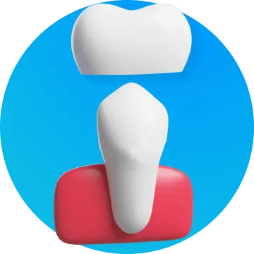 Zirconia Crowns