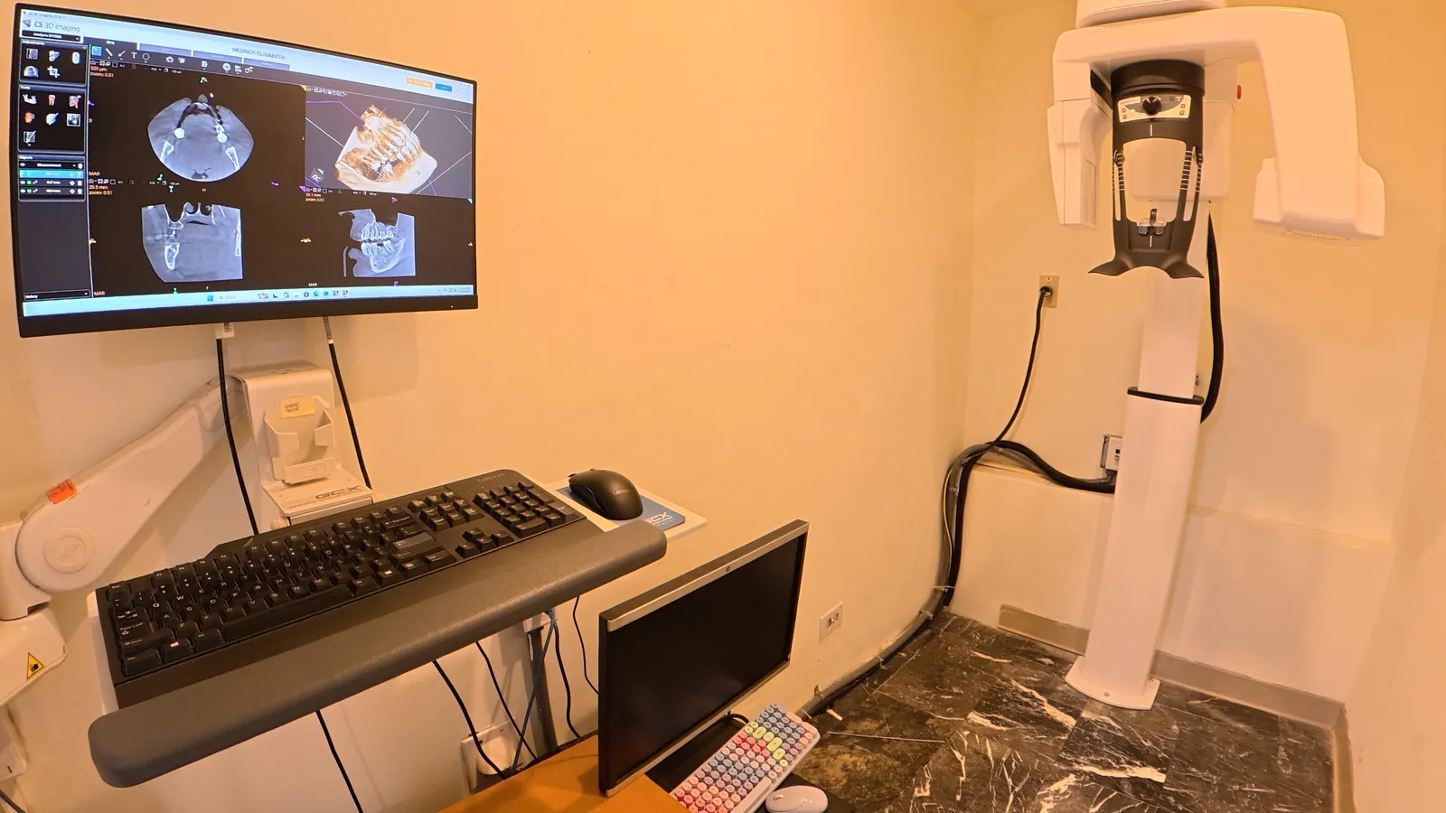 Cone beam 3D X-ray (CBCT) room