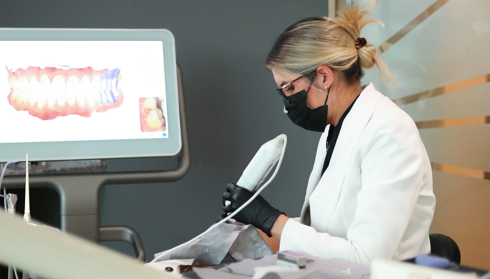 Digital smile design with intraoral scanner