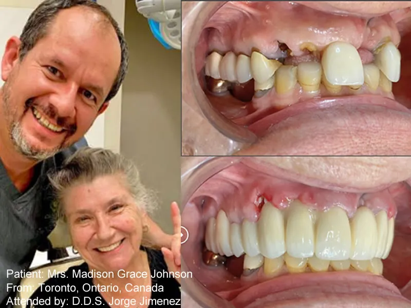Patient: Mrs. Madison Grace Johnson From: Toronto, Ontario, Canada Attended by: D.D.S. Jorge Jimene