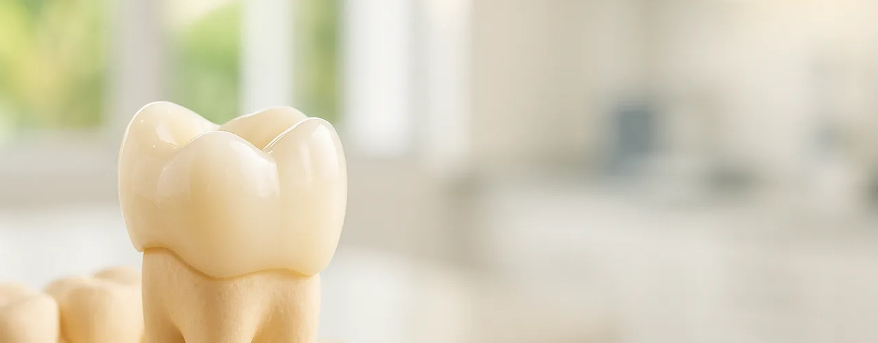 Dental Crowns in Playa del Carmen: Prices, Materials & Turnaround Times