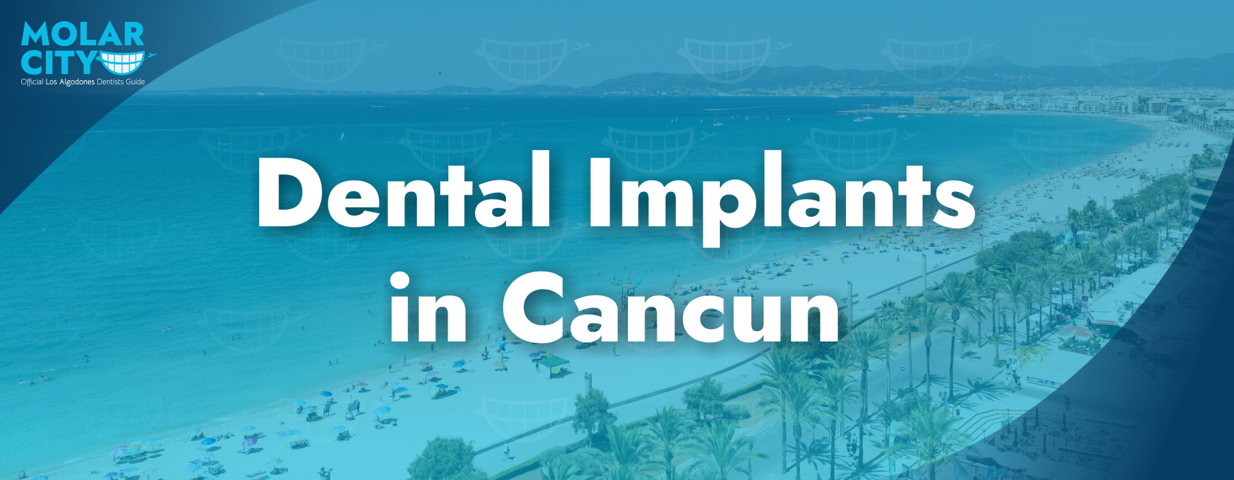 Dental Implants in Cancun