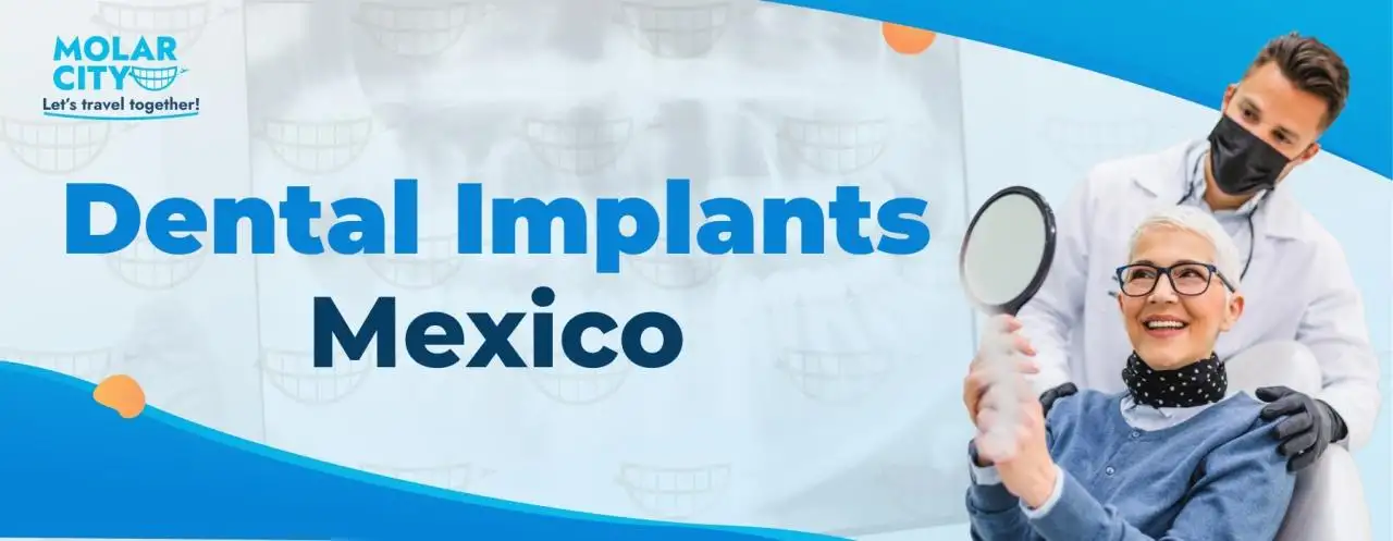 Dental Implants Mexico