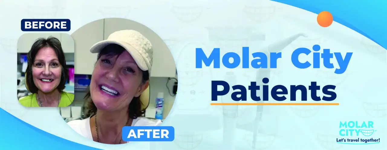 Molar City Patients