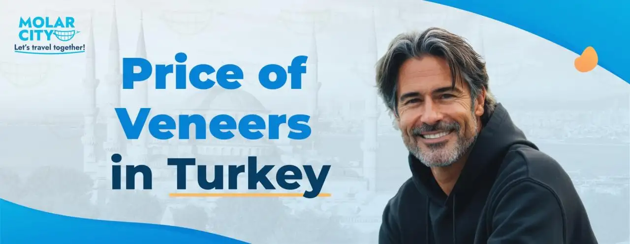 Price of Veneers in Turkey