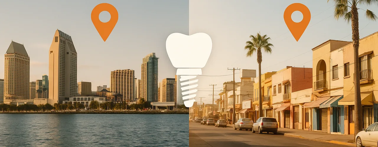 San Diego Dental Implants vs Tijuana: Cost & Quality Comparison