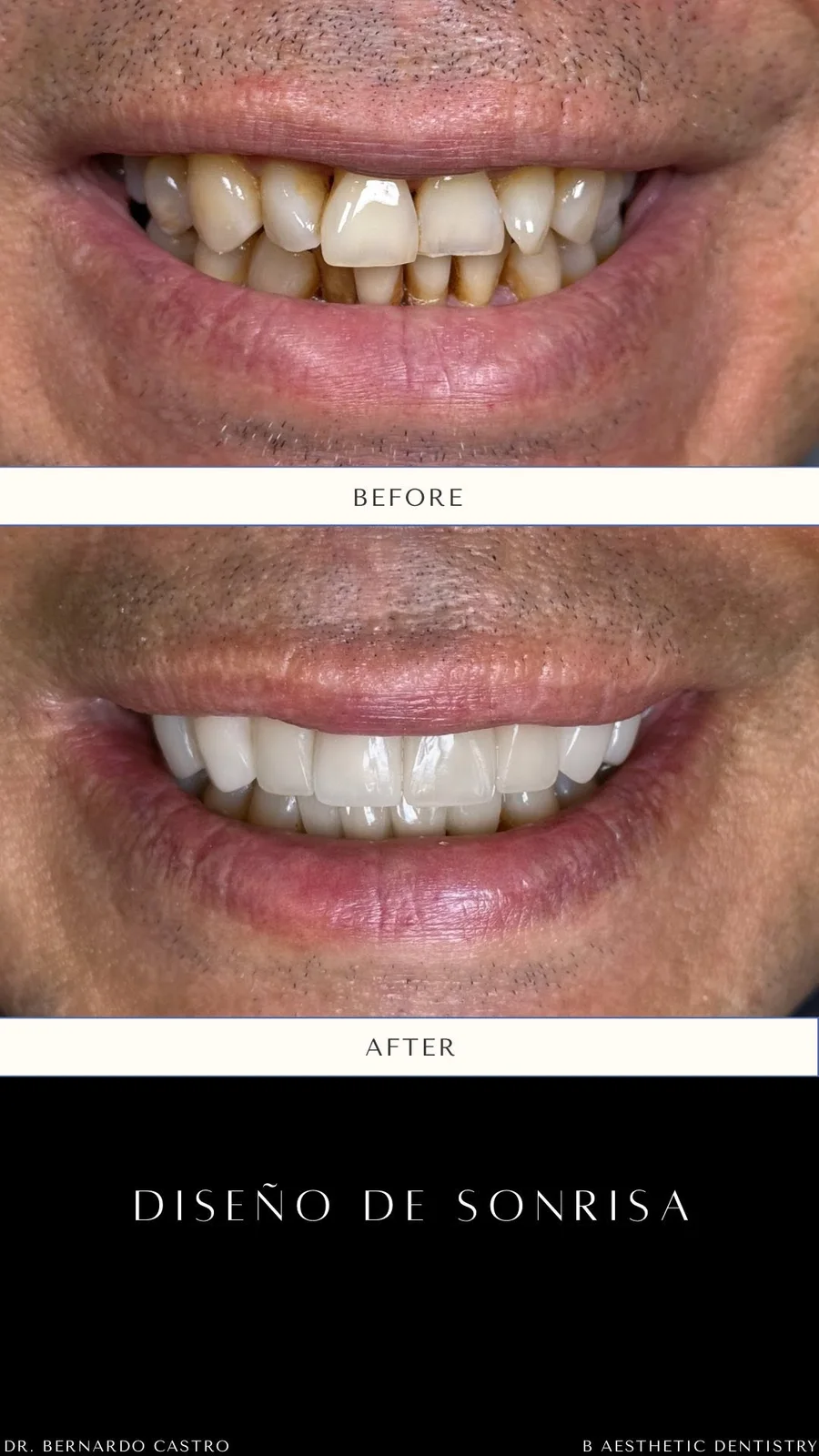 Treatment at B Aesthetic Dentistry