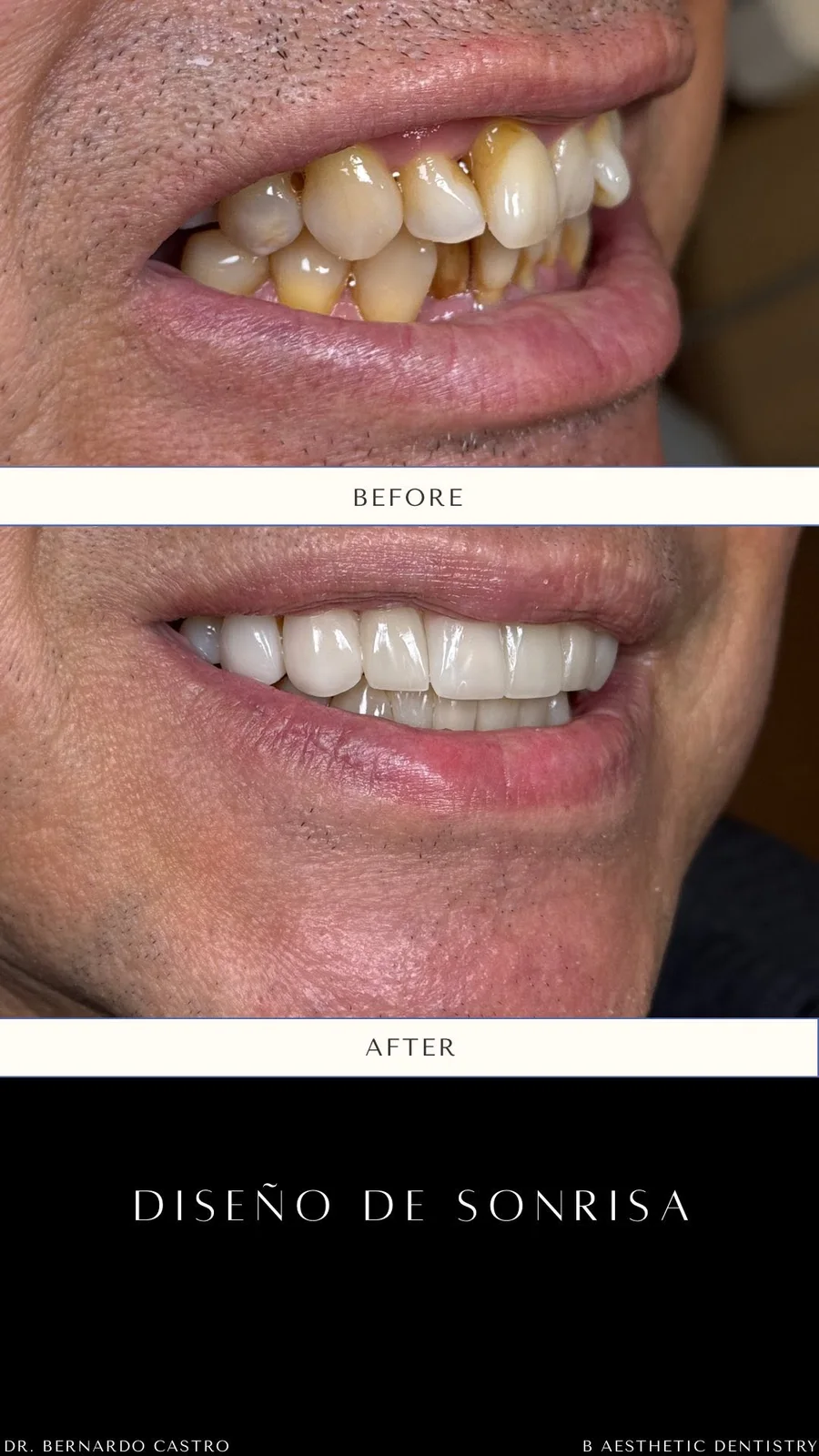 Aesthetic dentistry in progress