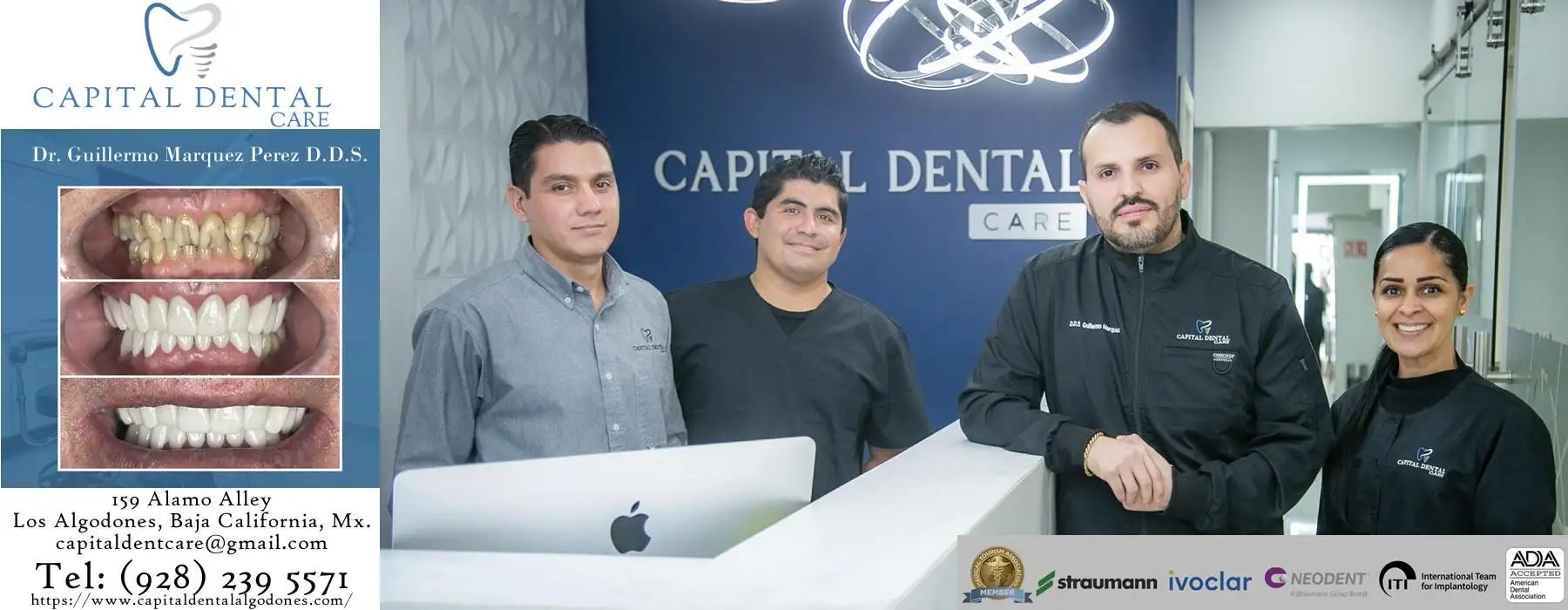 Save 50-70% on dental work at Capital Dental in Molar City, Los Algodones. Top-rated dentists serving US & Canadian patients with crowns, implants & veneers.