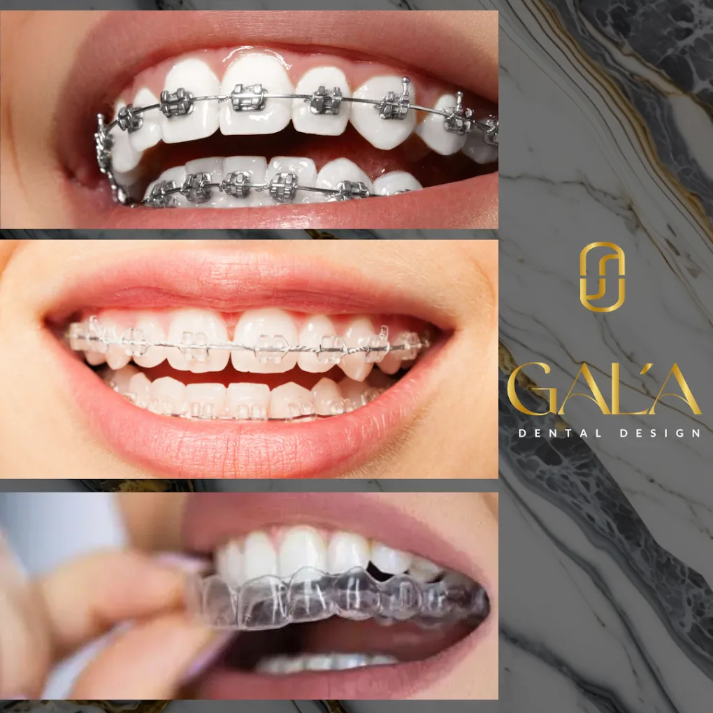 Braces & orthodontics