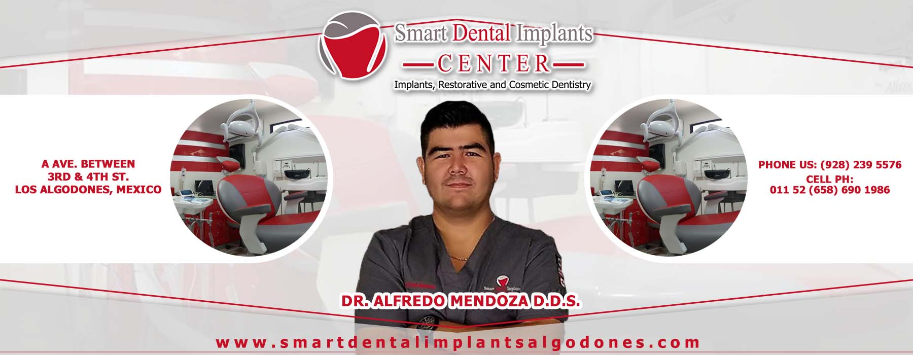  Smart Dental Implants